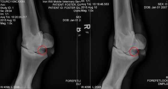 Bone chip on the right