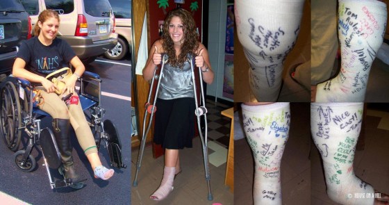 The progression of my first Ivan-injury